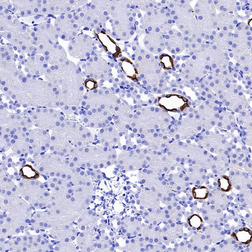 AQP2 Recombinant Rabbit mAb (SDT-2149-19)