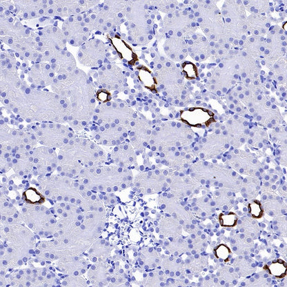 AQP2 Recombinant Rabbit mAb (SDT-2149-19)