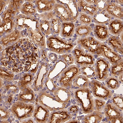 EEA1 Recombinant Rabbit mAb (S-2604-39)