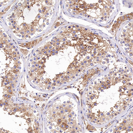 PSEN1 Recombinant Rabbit mAb (S-1002-129)