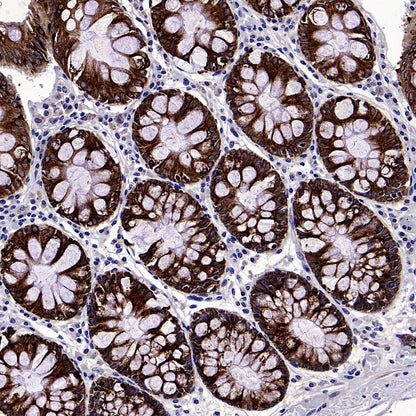 Anterior Gradient 2 Rabbit Polyclonal Antibody