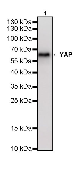 YAP Recombinant Rabbit mAb (S-3921-42)
