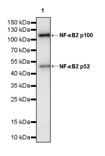 NF-κB2 p100/p52 Recombinant Rabbit mAb (S-2502-70)