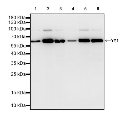 YY1 Recombinant Rabbit mAb (S-3652-44)