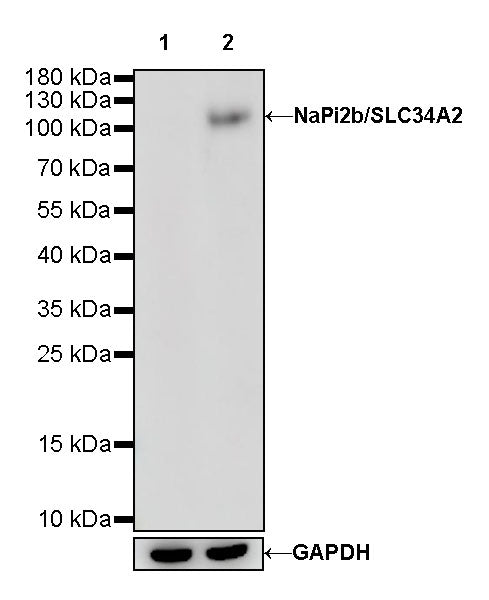 NaPi2b/SLC34A2 Recombinant Rabbit mAb (SDT-R229)