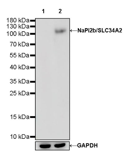 NaPi2b/SLC34A2 Recombinant Rabbit mAb (SDT-R229)