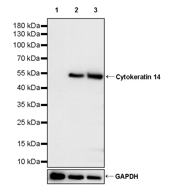 Cytokeratin 14 Recombinant Mouse mAb (S-M0003)