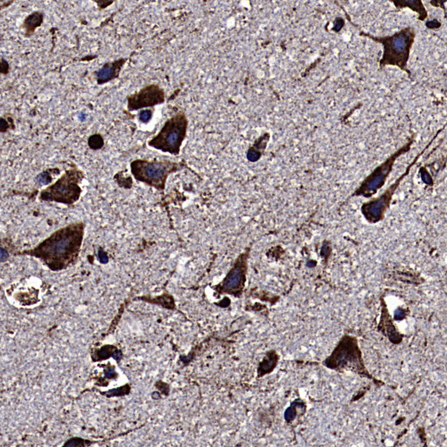 Calreticulin Recombinant Rabbit mAb (S-3920-39)