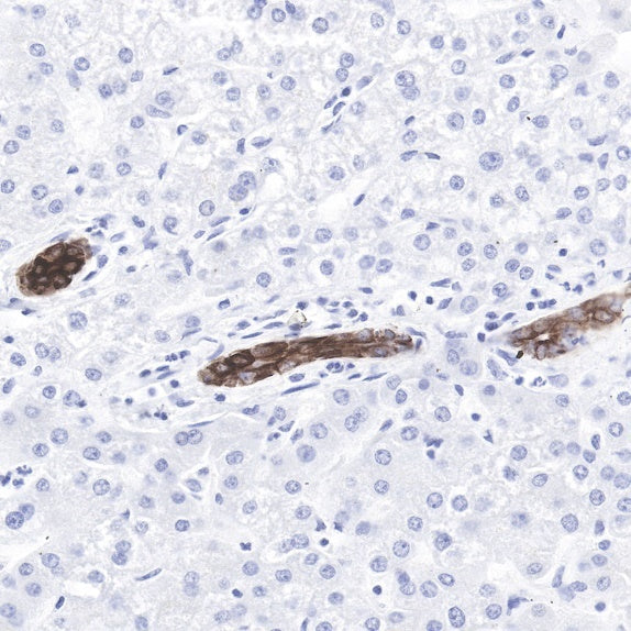 Cytokeratin 7 Recombinant Rabbit mAb (SDT-R028)