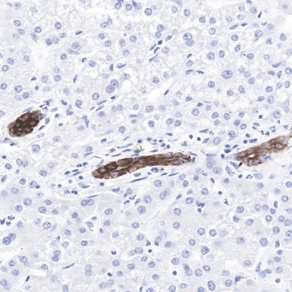 Cytokeratin 7 Recombinant Rabbit mAb (SDT-R028)