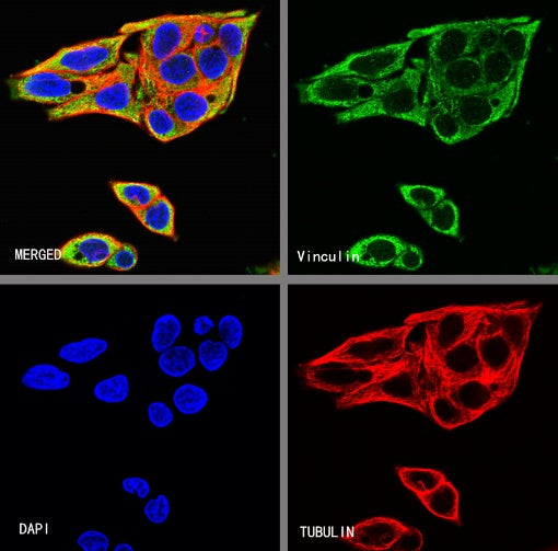 Vinculin Recombinant Rabbit mAb (S-1635-3)