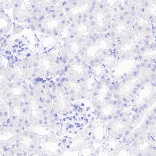 ETD Recombinant Rabbit mAb (S-3661-43)