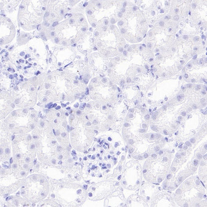 ETD Recombinant Rabbit mAb (S-3661-43)