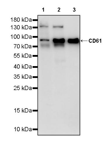 CD61 Recombinant Rabbit mAb (S-2515-6)