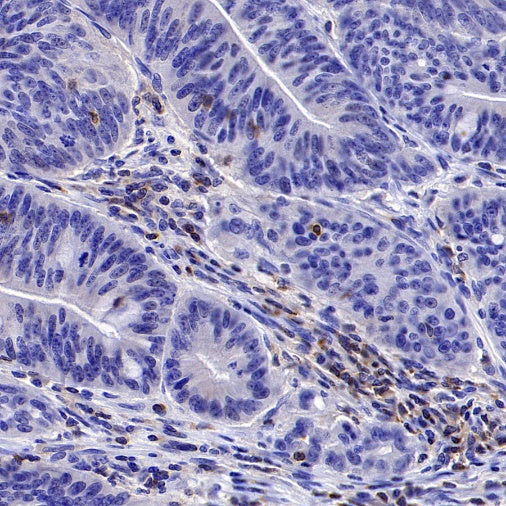 PIK3CD Recombinant Rabbit mAb (SDT-1978-148)