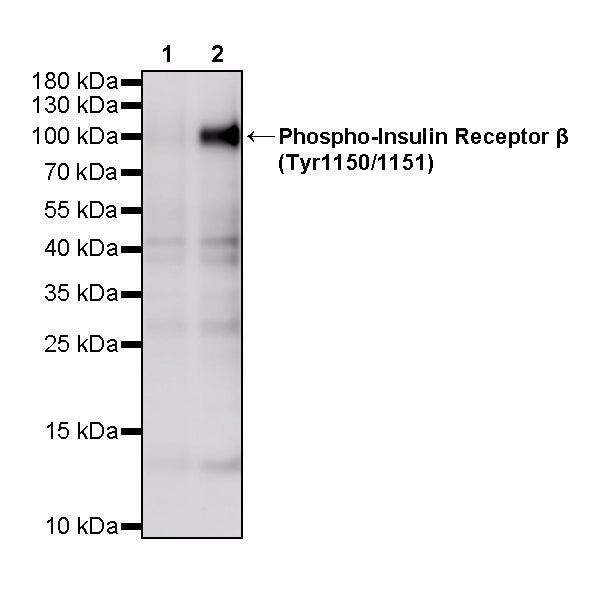 Phospho-Insulin Receptor β (Tyr1150/1151) Recombinant Rabbit mAb (S-4079-65)