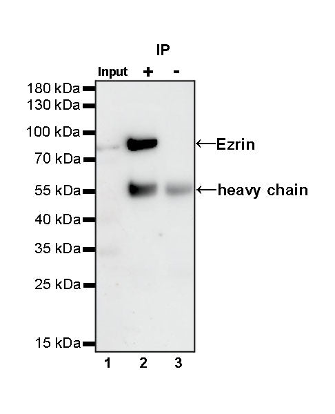 Ezrin Recombinant Rabbit mAb (S-R358)