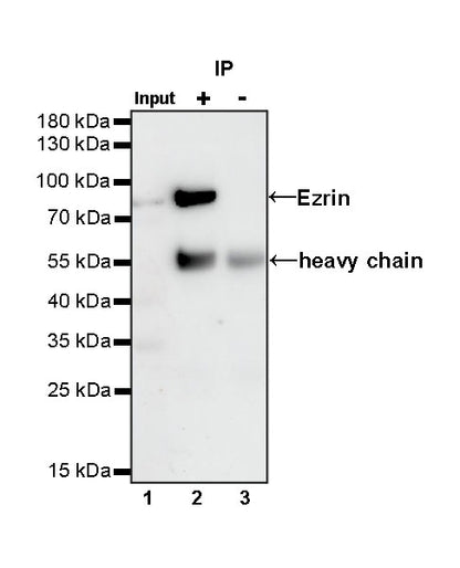 Ezrin Recombinant Rabbit mAb (S-R358)