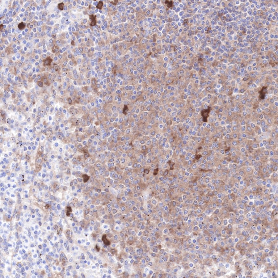 Hsp90 beta Recombinant Rabbit mAb (SDT-R033)