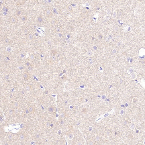 PDE4 Recombinant Rabbit mAb (S-2598-147)
