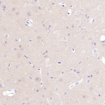 PDE4 Recombinant Rabbit mAb (S-2598-147)
