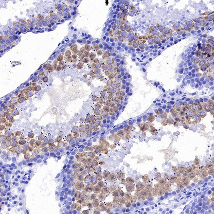 TACC3 Recombinant Rabbit mAb (S-3048-50)