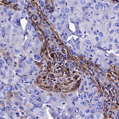 Lumican Recombinant Rabbit mAb (S-247-47)