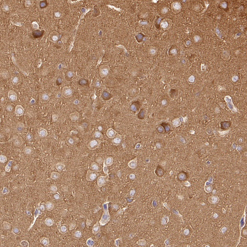 DRP1 Recombinant Rabbit mAb (S-1927-27)
