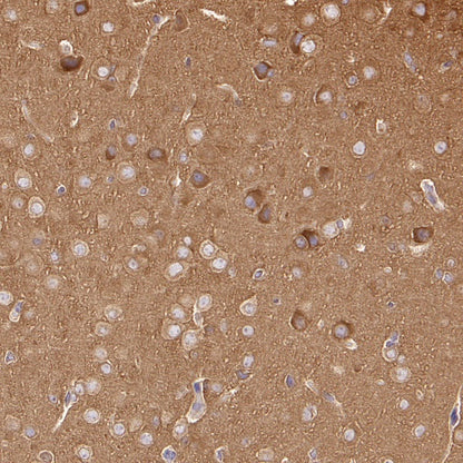DRP1 Recombinant Rabbit mAb (S-1927-27)