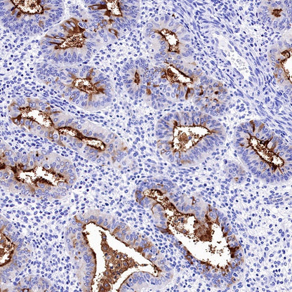 CD133 Recombinant Rabbit mAb(SDT-1295-22)
