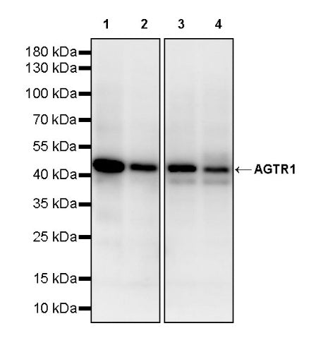 AGTR1 Recombinant Rabbit mAb (S-2447-22)