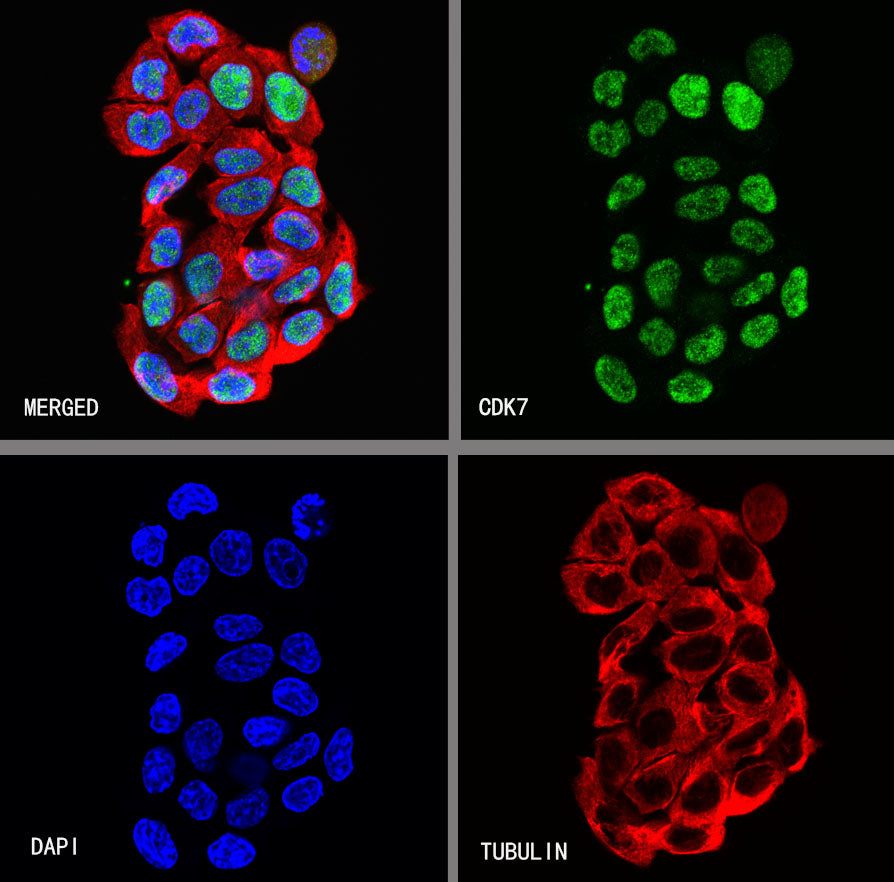 CDK7 Recombinant Rabbit mAb (S-2739-124)
