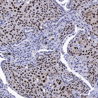 NSUN2 Mouse mAb