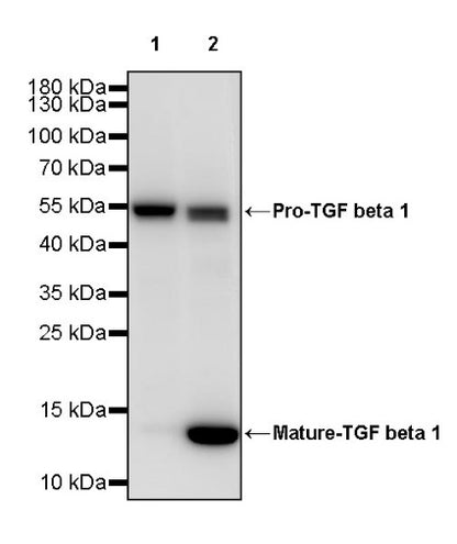 TGF beta 1 Recombinant Rabbit mAb (S-3204)