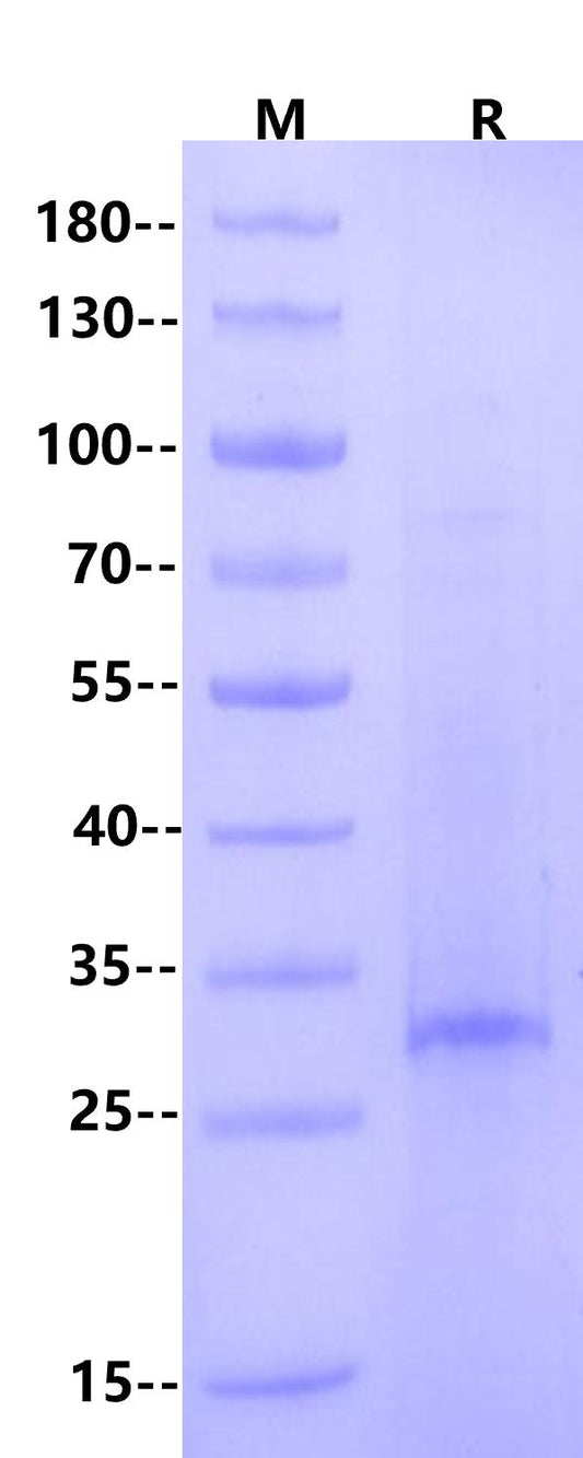GPRC5D Flag&His Tag Protein, Human(Detergent)