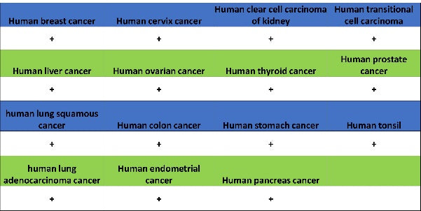 YTHDF2 Recombinant Rabbit mAb (S-1569-42)