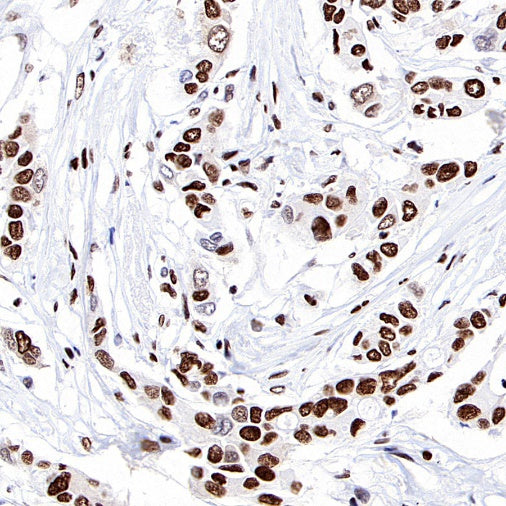 ARID1A Recombinant Rabbit mAb (S-440-27)