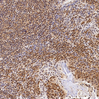 ACLY/ATP citrate lyase Recombinant Rabbit mAb (S-2025-32)