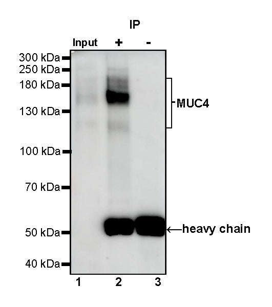MUC4 Recombinant Rabbit mAb,PBS Only (SDT-841-13)