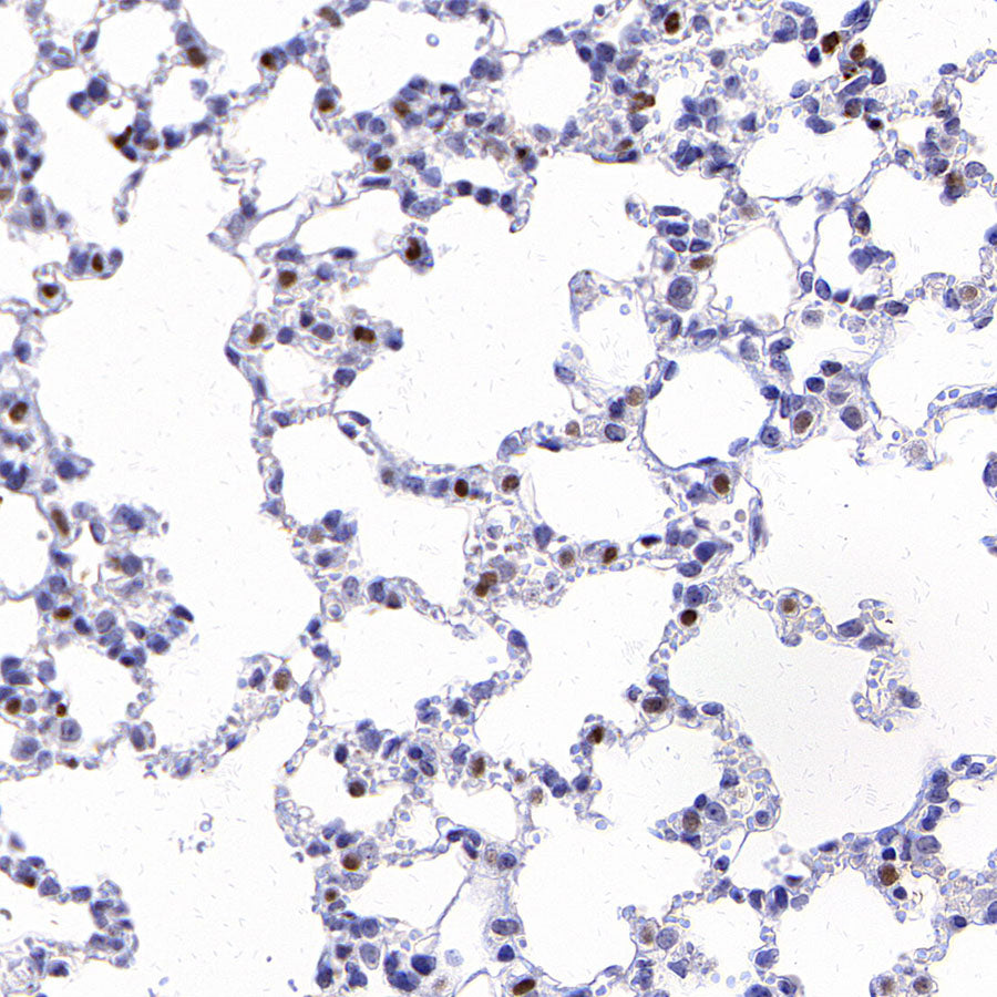 CD177 Rabbit Polyclonal Antibody