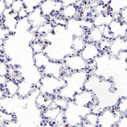 CD177 Rabbit Polyclonal Antibody