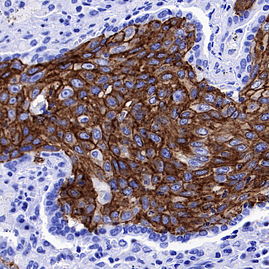 xCT Recombinant Rabbit mAb (S-5531)