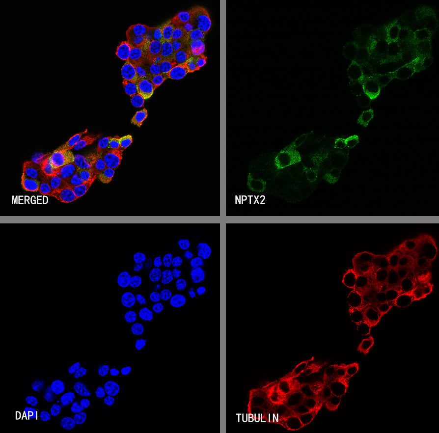 NPTX2 Recombinant Rabbit mAb (S-4048-54)