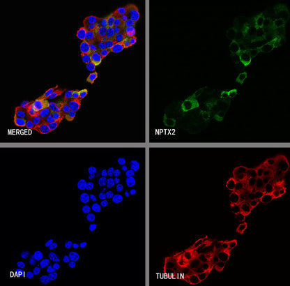NPTX2 Recombinant Rabbit mAb (S-4048-54)
