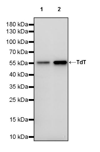 TdT Recombinant Rabbit mAb (S-2364-59)