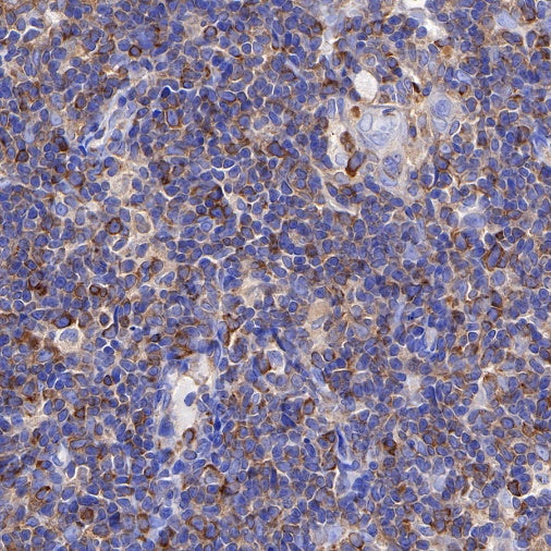 CD137 Recombinant Rabbit mAb (S-547-17)