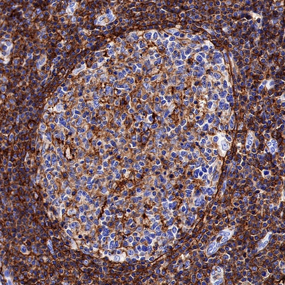 CD44 Recombinant Rabbit mAb (S-944-25)