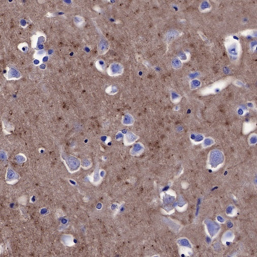 CD90 Recombinant Rabbit mAb (SDT-349-164)