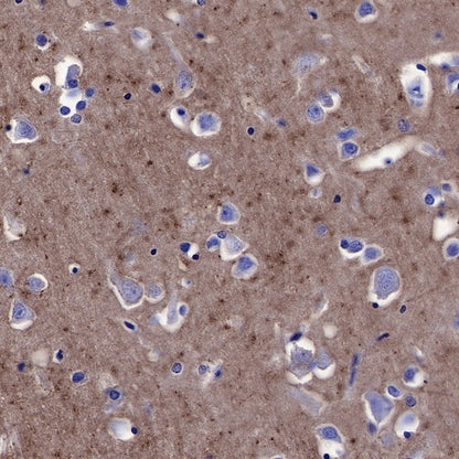 CD90 Recombinant Rabbit mAb (SDT-349-164)