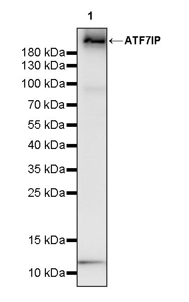ATF7IP Recombinant Rabbit mAb (S-4081-25)
